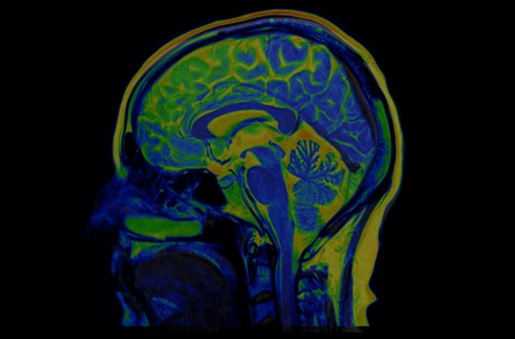 Brain MRI Scan of Healthy Male ( Magnetic Resonance Imaging)