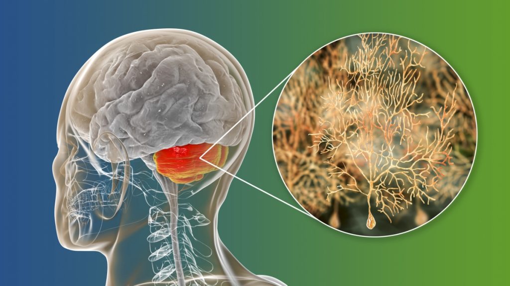 Human brain with highlighted cerebellum and close-up view of Purkinje neurons, one of the commonest types of cells in cerebellar cortex,