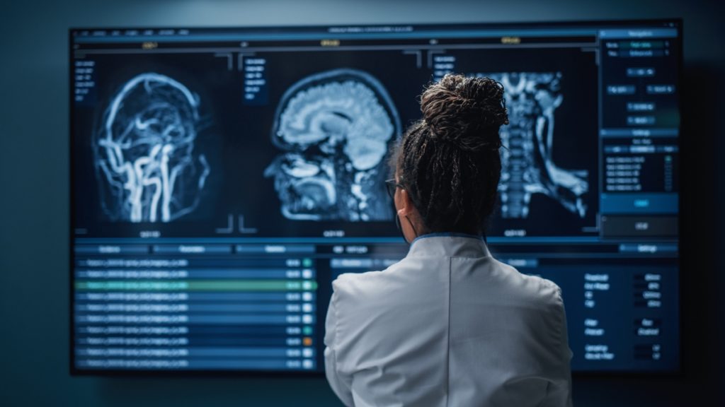 Female Neuroscientist Looking at TV Screen, Analyzing Brain Scan MRI Images, Finding Treatment for Patient.