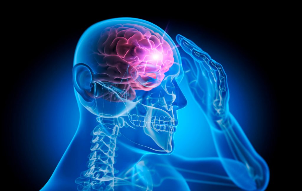 Medical X-Ray illustration of a man with heavy headache