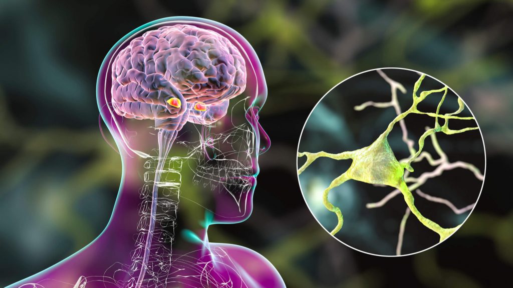 Amygdala in the brain, and closeup view of amygdala neurons