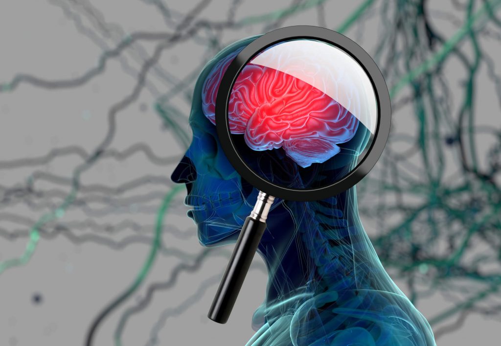 magnifying glass examining brain's blood barrier