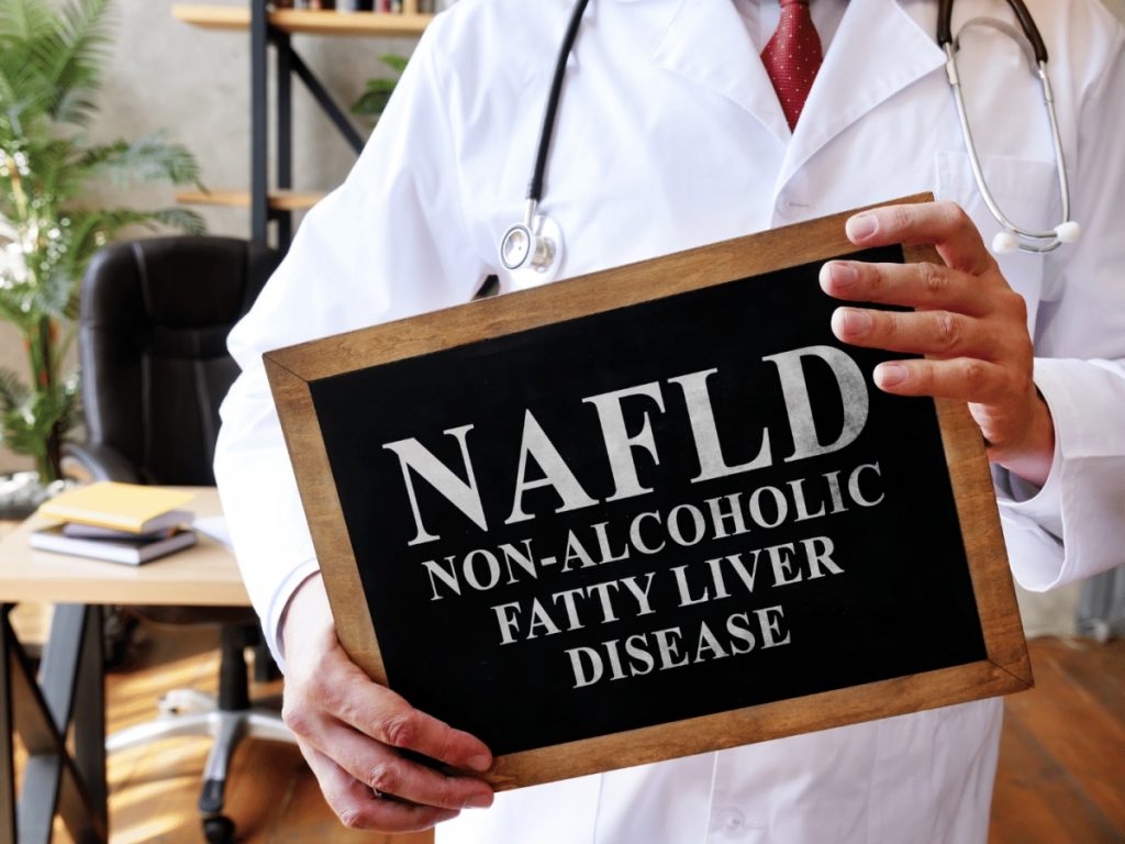 non-alcoholic fatty liver disease