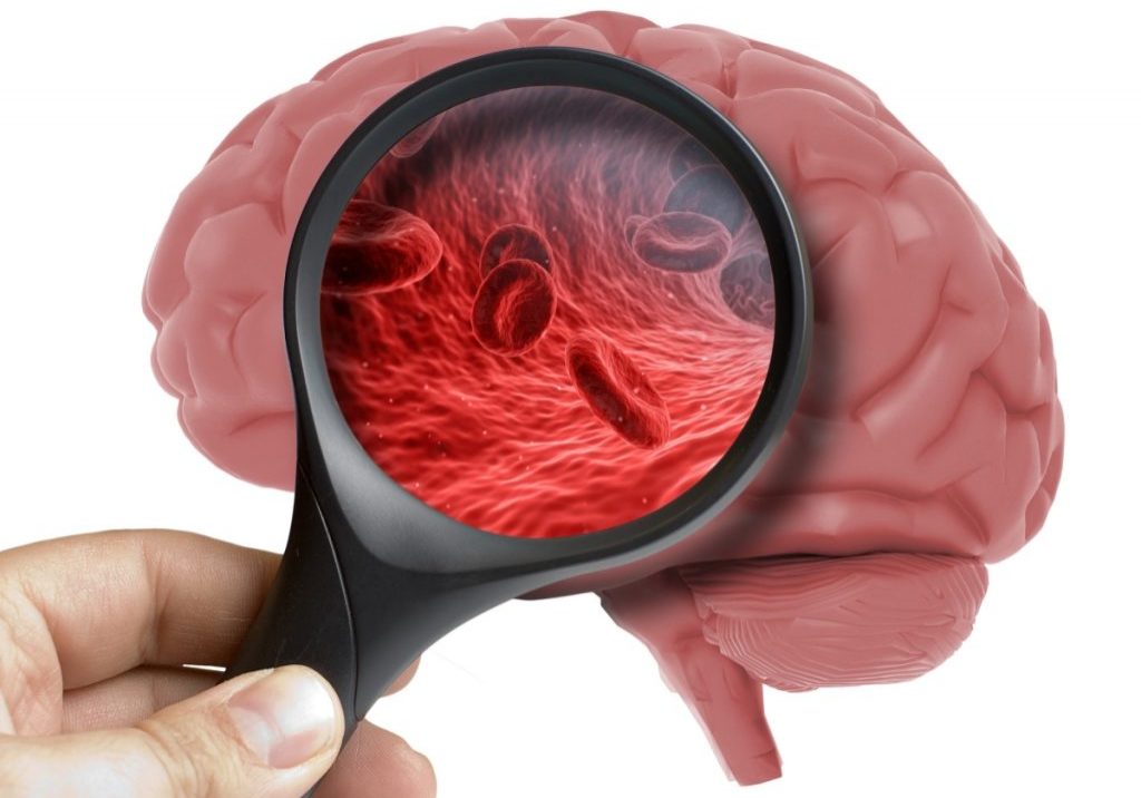 low-cerebral-blood-flow-causes-symptoms-and-effects